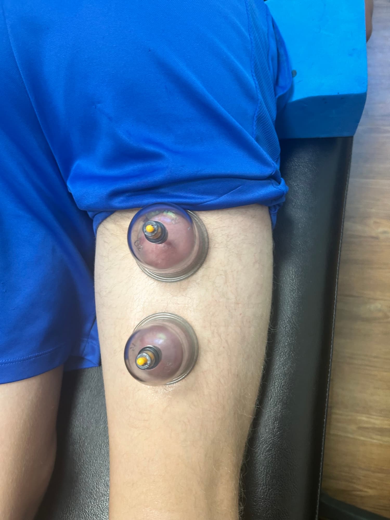 Targeted placement along the quadriceps and thigh